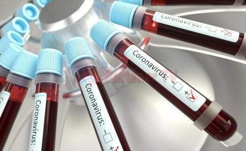 Laboratoarele sanitare veterinare județene dau o mână de ajutor în lupta cu COVID-19