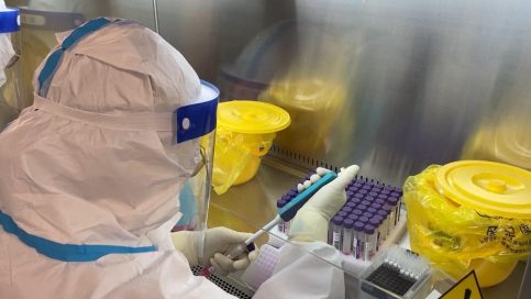 ATENȚIE! TESTUL ANTIGEN cel mai probabil IESE NEGATIV la infecția cu varianta Omicron